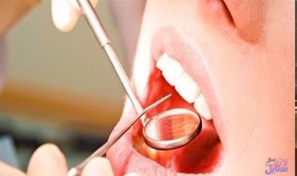 دراسة حديثة تكشف العلاقة بين مرض اللثة والإصابة بالسرطان
