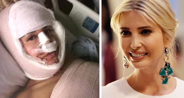 إمرأة تجري 13 عملية وتعرّض حياتها للخطر لتشبه إبنة ترامب