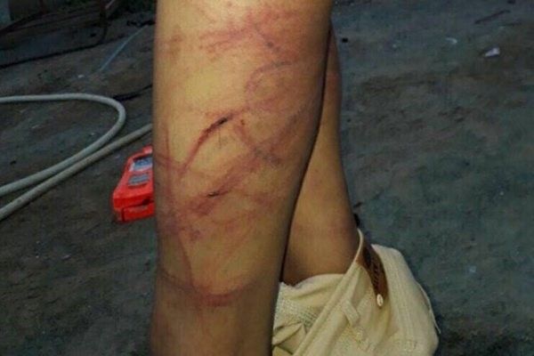 السعودية | السعودية.. "يتيم" يتعرض لضرب مبرح من أخواله