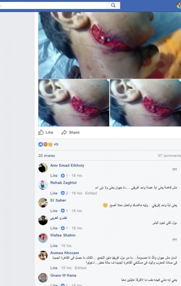 شاب إفريقي يعض طفل في القاهرة الجديدة.. ونشطاء: "زومبي"