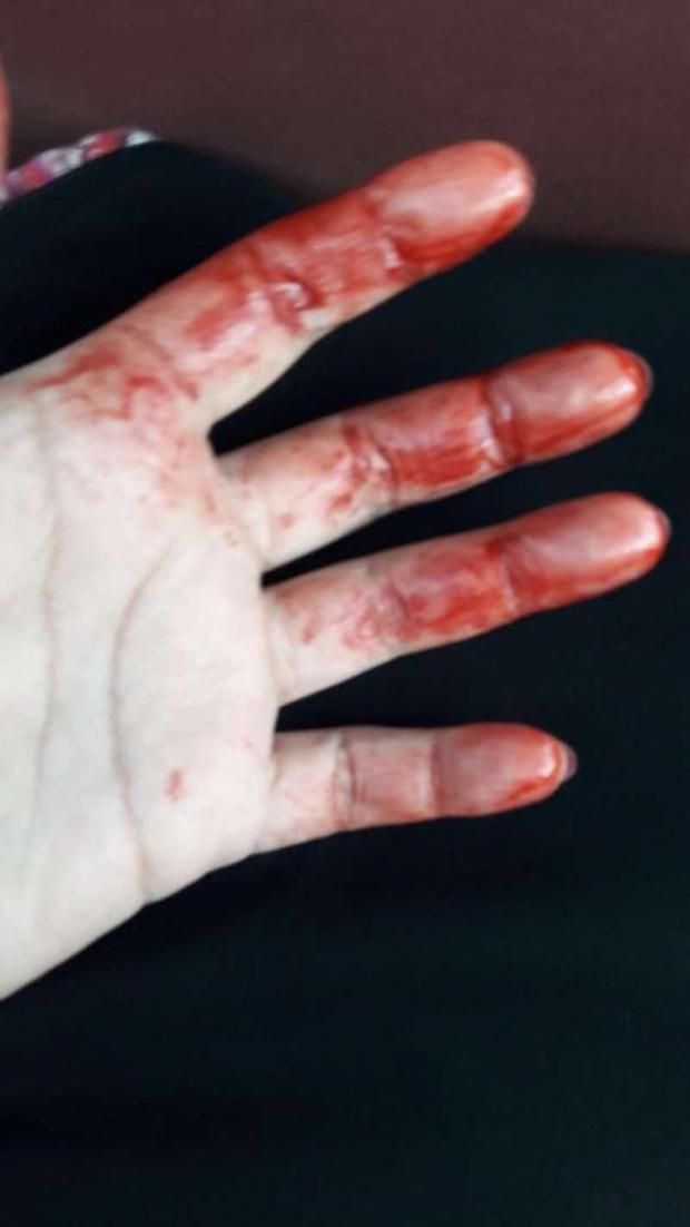 بالصور| رجل يحاول قتل زوجته داخل "سوبر ماركت": "ضربها بسكينة"