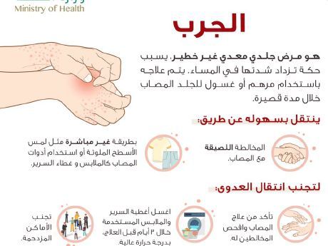 تثقيف 550 طالباً في بقيق حول مرض الجرب