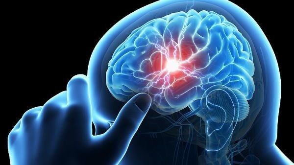 احذر.. هذه العلامات الـ6 تنذر بتعرضك للسكتة الدماغية