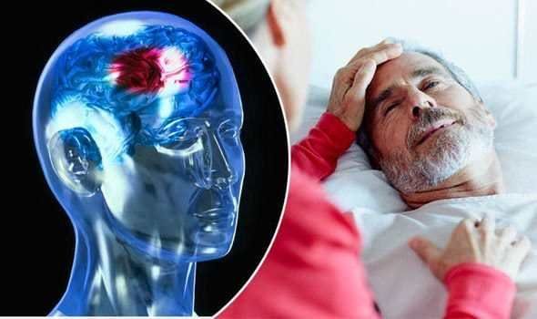 احذر.. هذه العلامات الـ6 تنذر بتعرضك للسكتة الدماغية