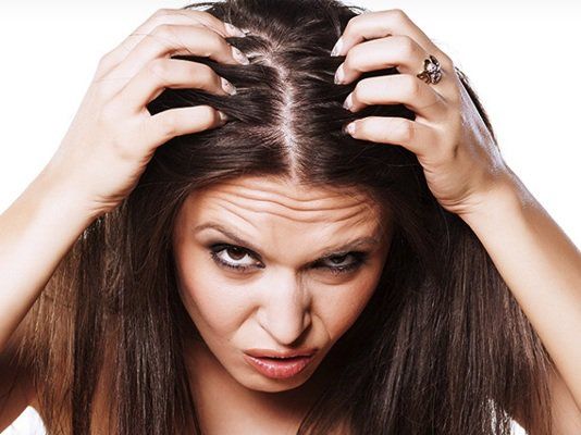 طرق طبيعية للتخلص من قشرة الشعر.. ولهذا السبب تزداد في الشتاء