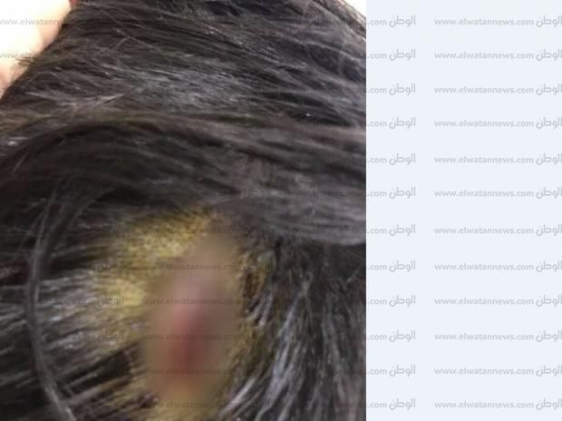 بالصور| خالة «طفل مدينتي» تروي تفاصيل واقعة مهاجمته من كلبين «شديدي الشراسة»