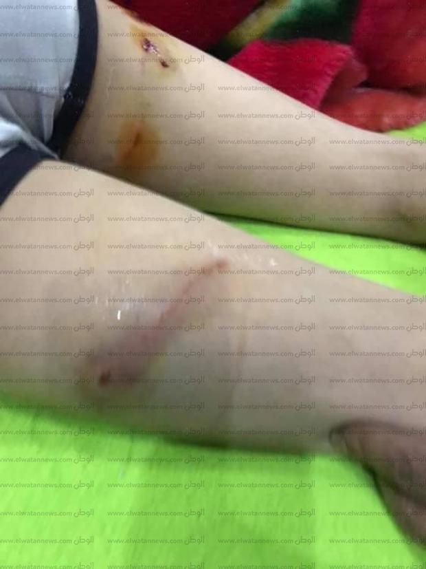 بالصور| خالة «طفل مدينتي» تروي تفاصيل واقعة مهاجمته من كلبين «شديدي الشراسة»