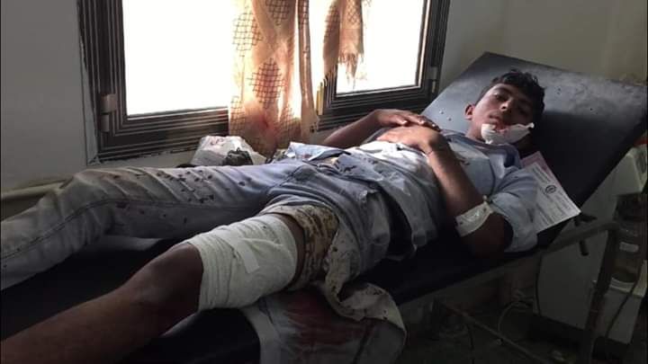 بالصور.. مشاهد حية من جبهة مريس تكشف عن مرتزقة أجانب يقاتلون في صفوف الحوثيين وعن عدد شهداء وجرحى "العود"