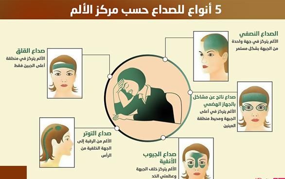 انواع الصداع بالصور