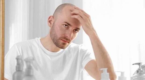 7 نصائح لعلاج الصلع
