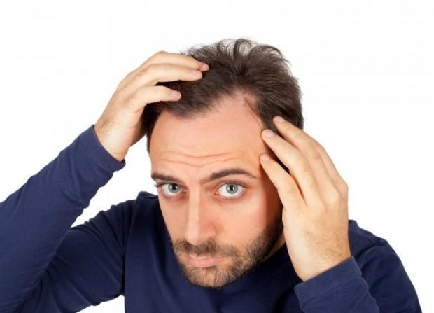 7 نصائح لعلاج الصلع