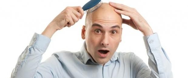 7 نصائح لعلاج الصلع