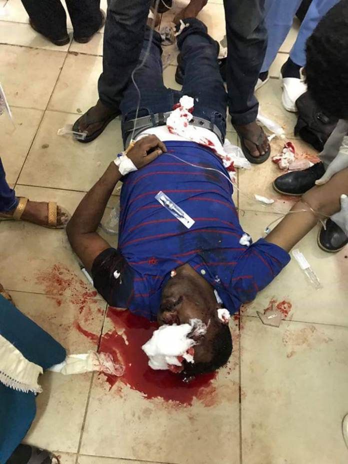شاهد بالفيديو : شاهد عيان يروي تفاصيل مجزرة الأبيض التي وقعت ظهر اليوم……