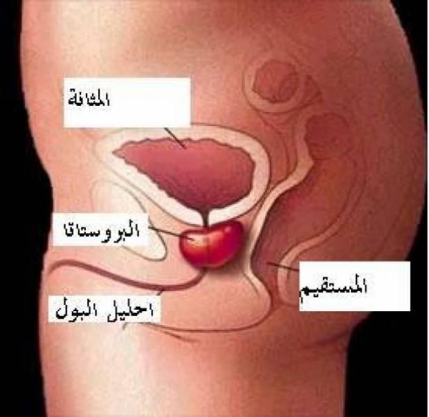 أسباب تضخم البروستاتا الحميد وأعراضه ومضاعفاته