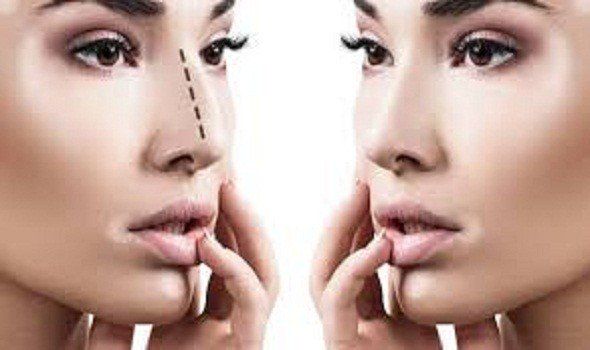 طريقتان جديدتان لتجميل الأنف من دون جراحة