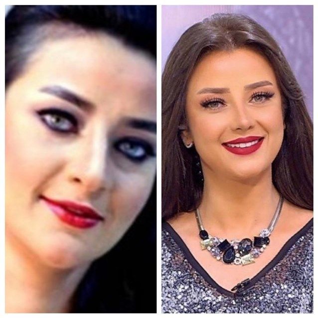 رضوى الشربيني تتعرّض للسخرية بسبب شكلها السابق والحالي