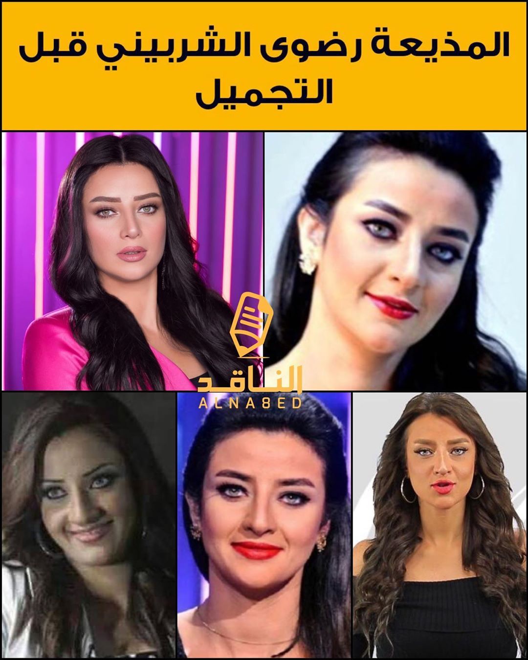 رضوى الشربيني تتعرّض للسخرية بسبب شكلها السابق والحالي