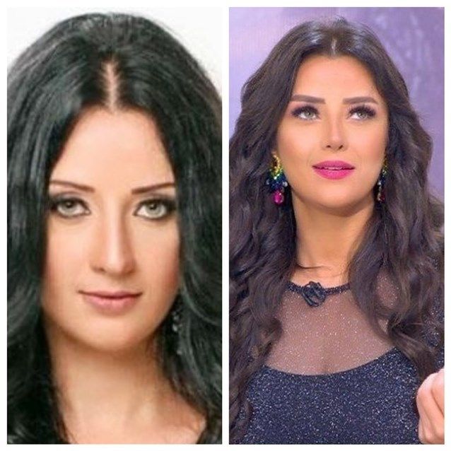 رضوى الشربيني تتعرّض للسخرية بسبب شكلها السابق والحالي