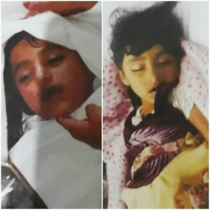في ظروف غامضة.. العثور على طفلة مشنوقة في مدينة جبلة