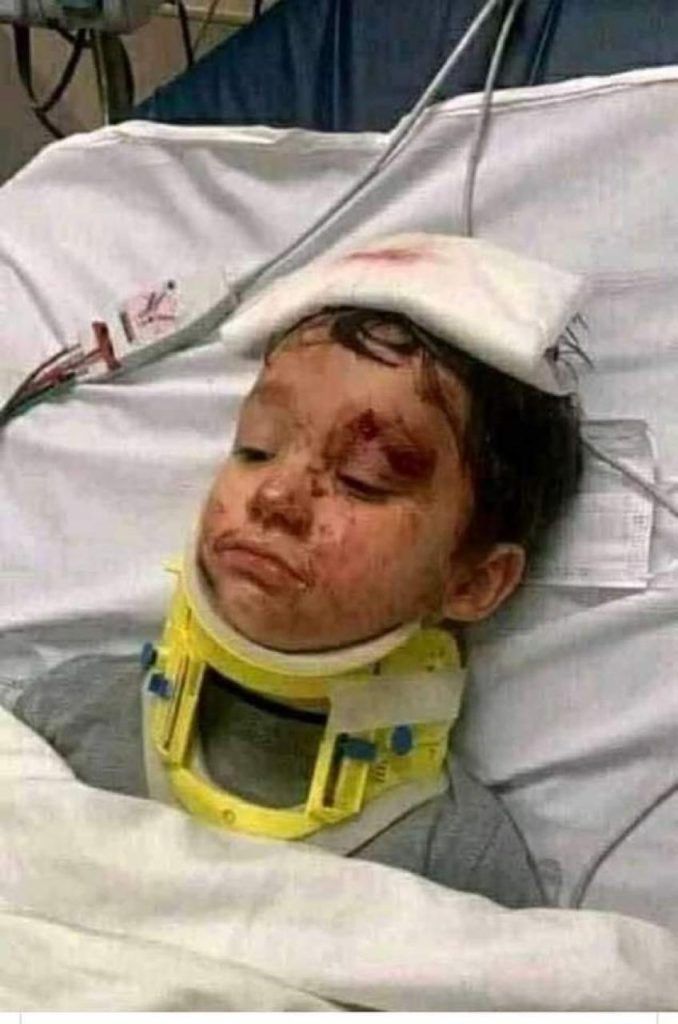 من داخل سيارة الإسعاف.. ننشر أول صورة للطفل ريان بعد إخراجه من البئر ميتًا