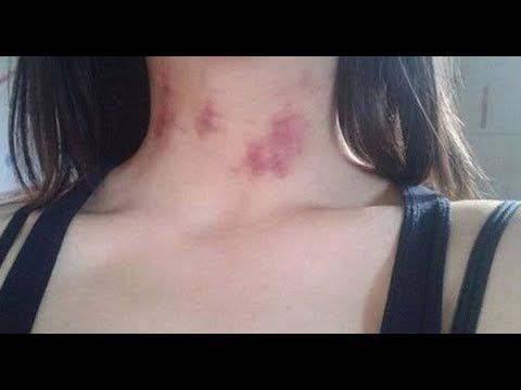 نسيت تغطي عنقها.. هفوه من الأميرة رجوة زوجة ولي عهد الأردن نشرت صورتها وعنقها ملطخ بعلامات شهر العسل.. شاهد الصورة التي ستدفع كل ثروتها عشان حذفها!