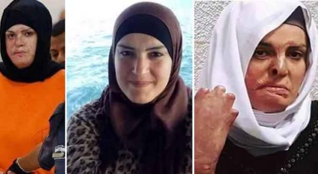 كيف تغيرت ملامح إسراء جعابيص قبل وبعد الاعتقال؟.. تفاصيل مؤلمة من داخل سجون الاحتلال