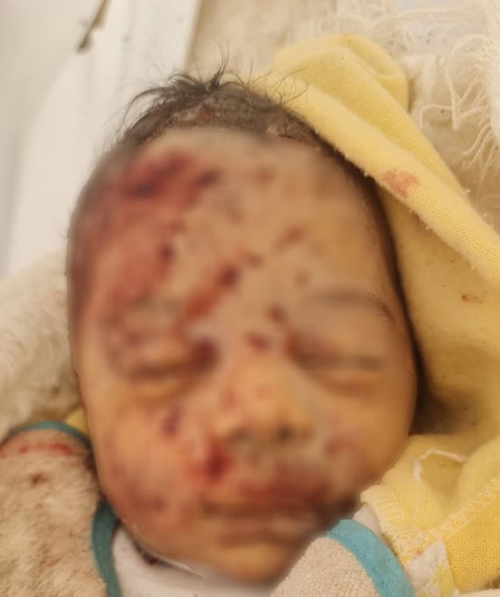 بعد قليل.. تحقيق استقصائى يوثق استخدام إسرائيل أسلحة محرمة دوليا بغزة