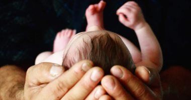 حالات يجب تأخير ختان المواليد الذكور فيها.. أستاذ جراحة أطفال يوضح