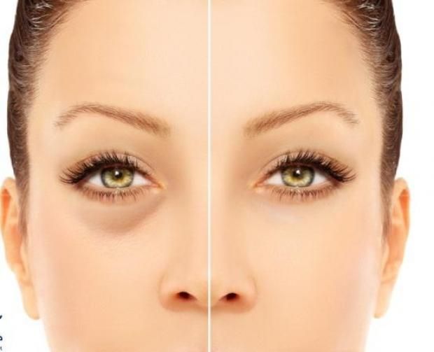 8 تحاليل لازم تعمليها بعد سن الـ40.. تقي من 3 أمراض خطيرة