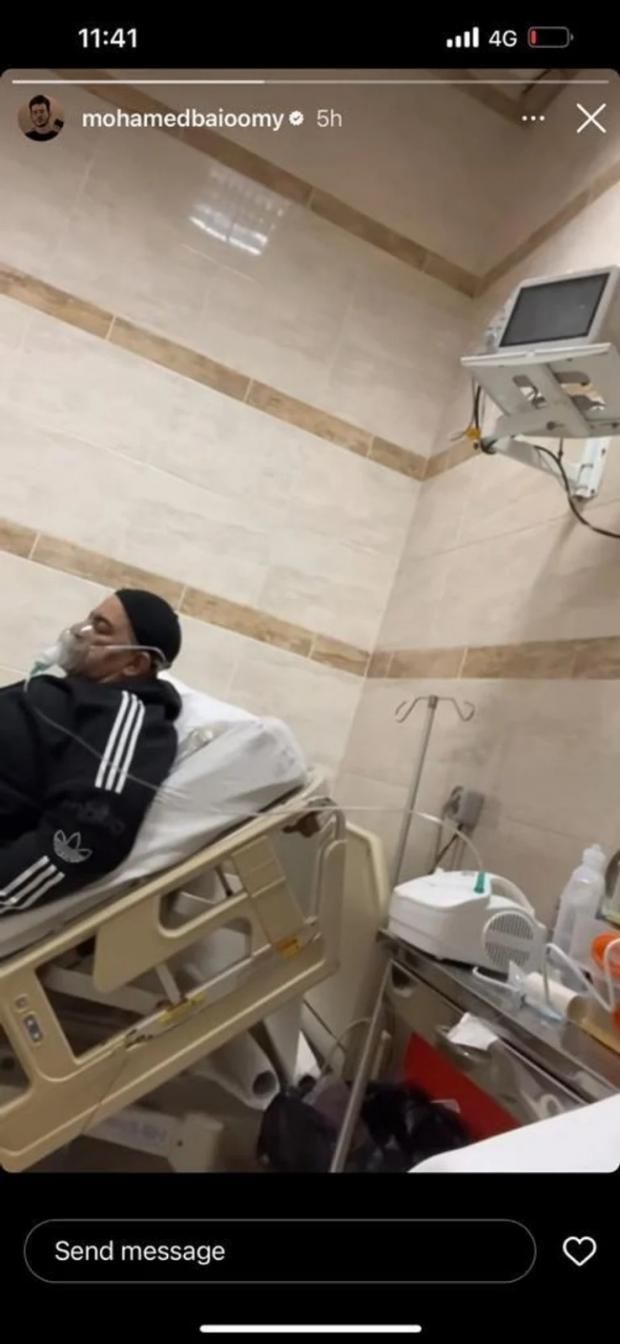 بعد إصابة بيومي فؤاد بها.. ما هي أسباب الأزمة التنفسية؟