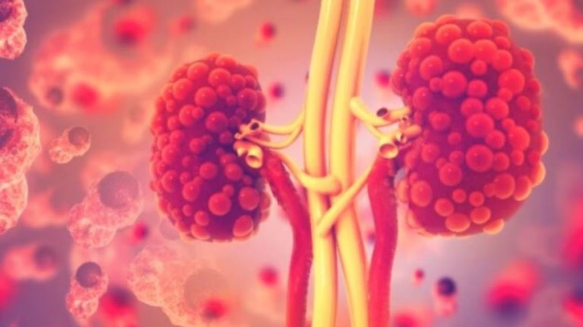 تراند اليوم : الكثير منه يضر.. إليك 5 آثار جانبية للكركم يجب معرفتها