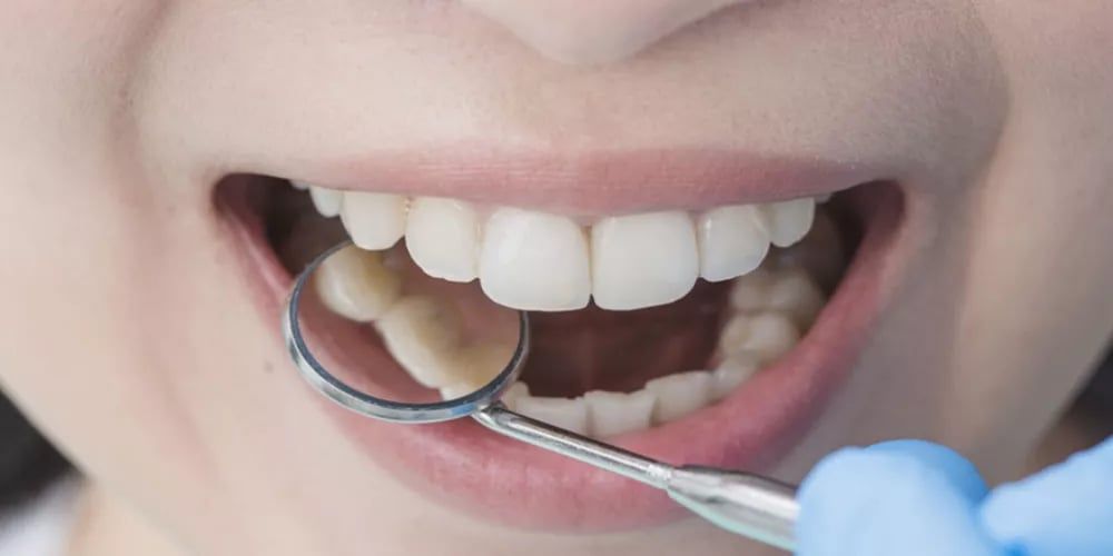 أحدها يوجِب مراجعة الطبيب فورًا.. أخصائية روسية تكشف أبرز 4 أنواع لألم الأسنان