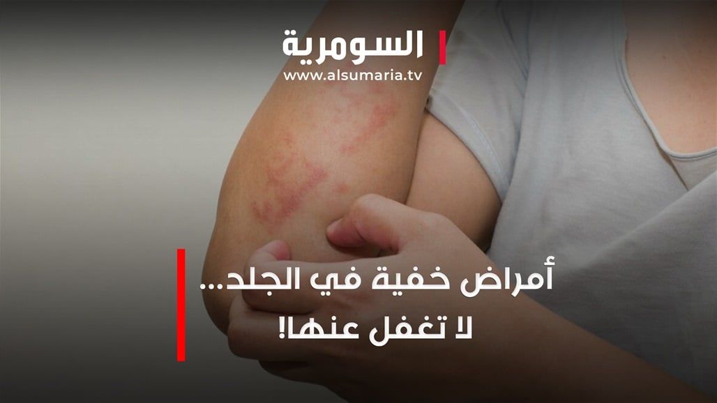أمراض خفية في الجلد.. لا تغفل عنها!