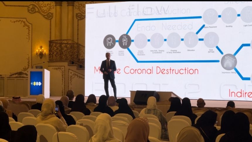 فيديو| "السعودية للجذور وأعصاب الأسنان" لـ"اليوم": المملكة من أعلى الدول بنسب التسوس