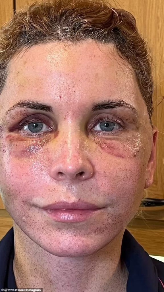 طبيب تجميل لبناني ينقذ ممثلة عالمية بعد تشوّه وجهها بالكامل