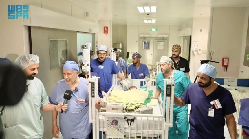 بعد جراحة معقدة.. نجاح فصل التوأمين السياميين النيجيريين