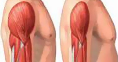 أشهر أسباب وأعراض تيبس العضلات