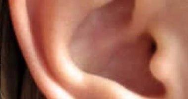 شد الطفل أذنه علامة على وجود مشكلة.. طبيب يوضح