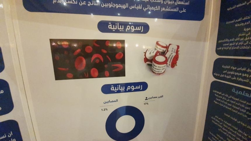 طالبة تبتكر جهازًا لمرضى الدم المنجلي يحد من نوبات الألم
