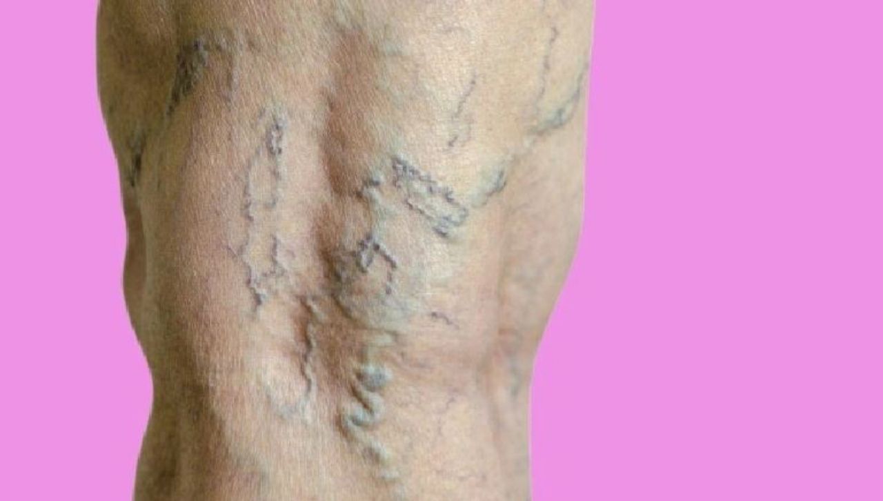 احذر 7 مخاطر صحية للجلوس لفترات طويلة