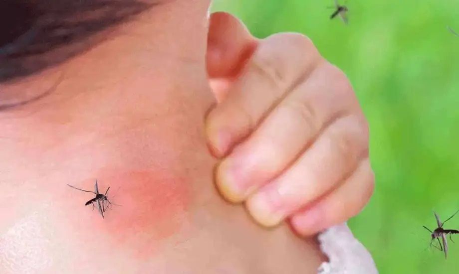الامارات | ابتعد عنها لتجنب اللدغات المزعجة.. 4 ألوان تجذب البعوض في فصل الصيف