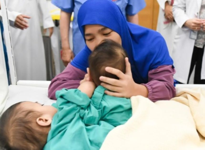 إنفاذًا لتوجيهات القيادة.. بدء فصل التوأمين السياميين الفلبينيين "أكيزا وعائشة"