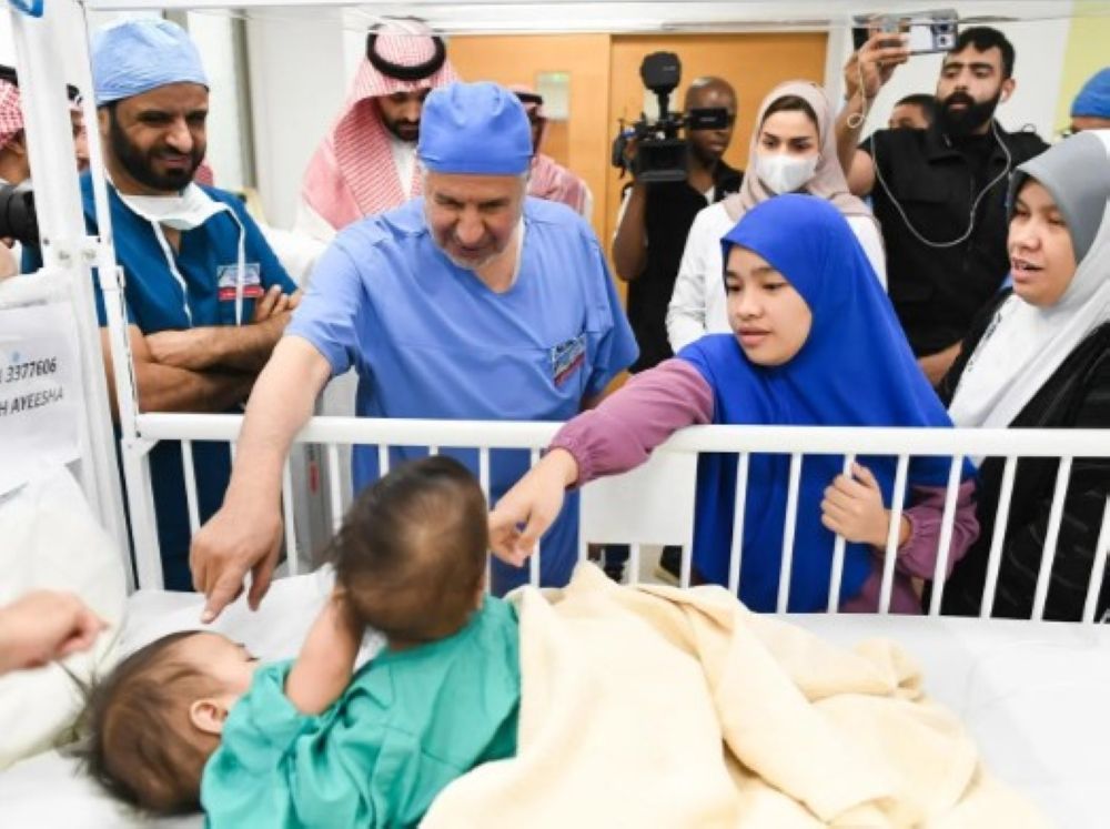 إنفاذًا لتوجيهات القيادة.. بدء فصل التوأمين السياميين الفلبينيين "أكيزا وعائشة"