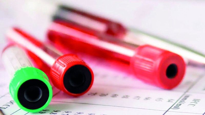 الامارات | اختبار فاعلية علاجات جديدة لـ «الثلاسيميا»