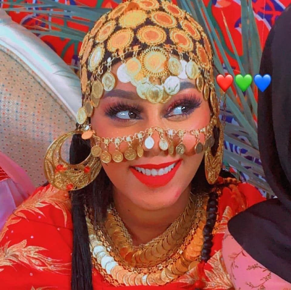 شاهد بالصورة والفيديو.. ممثلة سودانية حسناء تحكي قصتها مع أحد أفراد الدعم السريع بعد أن تزوجها غصباً عنها وغدر بها برصاصة في الشارع العام كادت أن تودي بحياتها