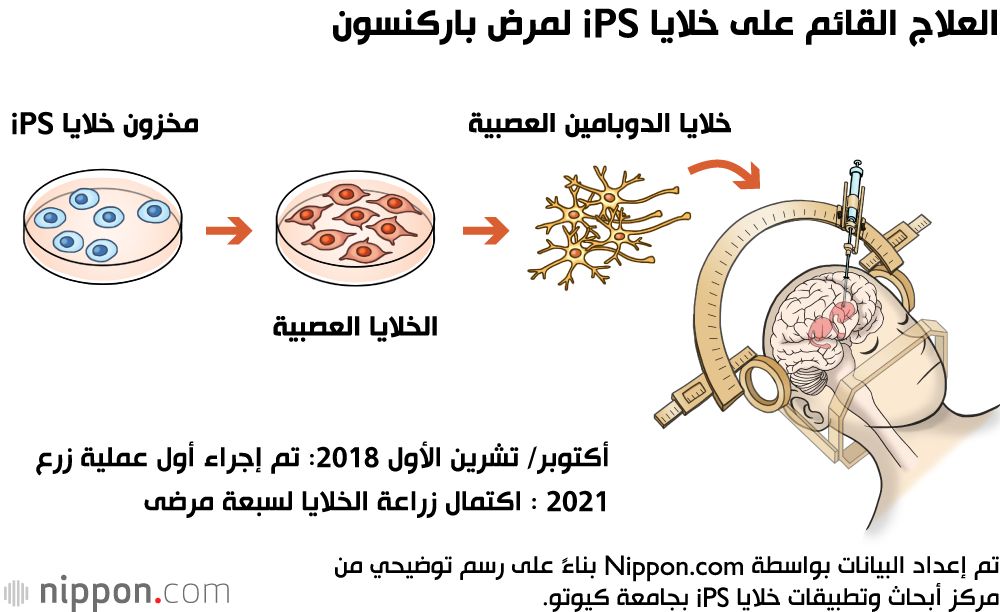 اليابان | اليابان على أعتاب ثورة طبية... هل تكون الخلايا الجذعية هي الحل؟
