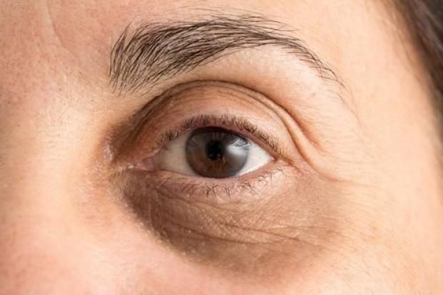 احذر.. علامة في العين قد تنذر بإصابتك بمرض عقلي