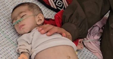 ماتت من الجوع.. وفاة طفلة من غزة بسبب المجاعة والعدد يرتفع لـ54 طفلا