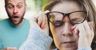 نصائح وعلاجات سهلة لنزلات البرد والحساسية فى الربيع