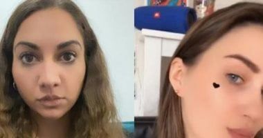 انسَ الفلاتر.. هذه العلاجات للبشرة في 30 دقيقة تمنحك إشراقة حقيقية